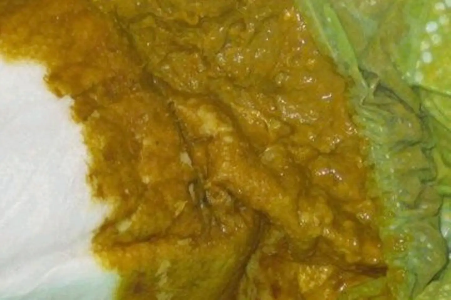 stuhlgang muttermilch - Warum ist Muttermilchstuhl körnig