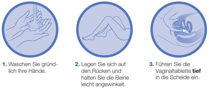 gynoflor schwangerschaft - Warum muss Gynoflor in den Kühlschrank