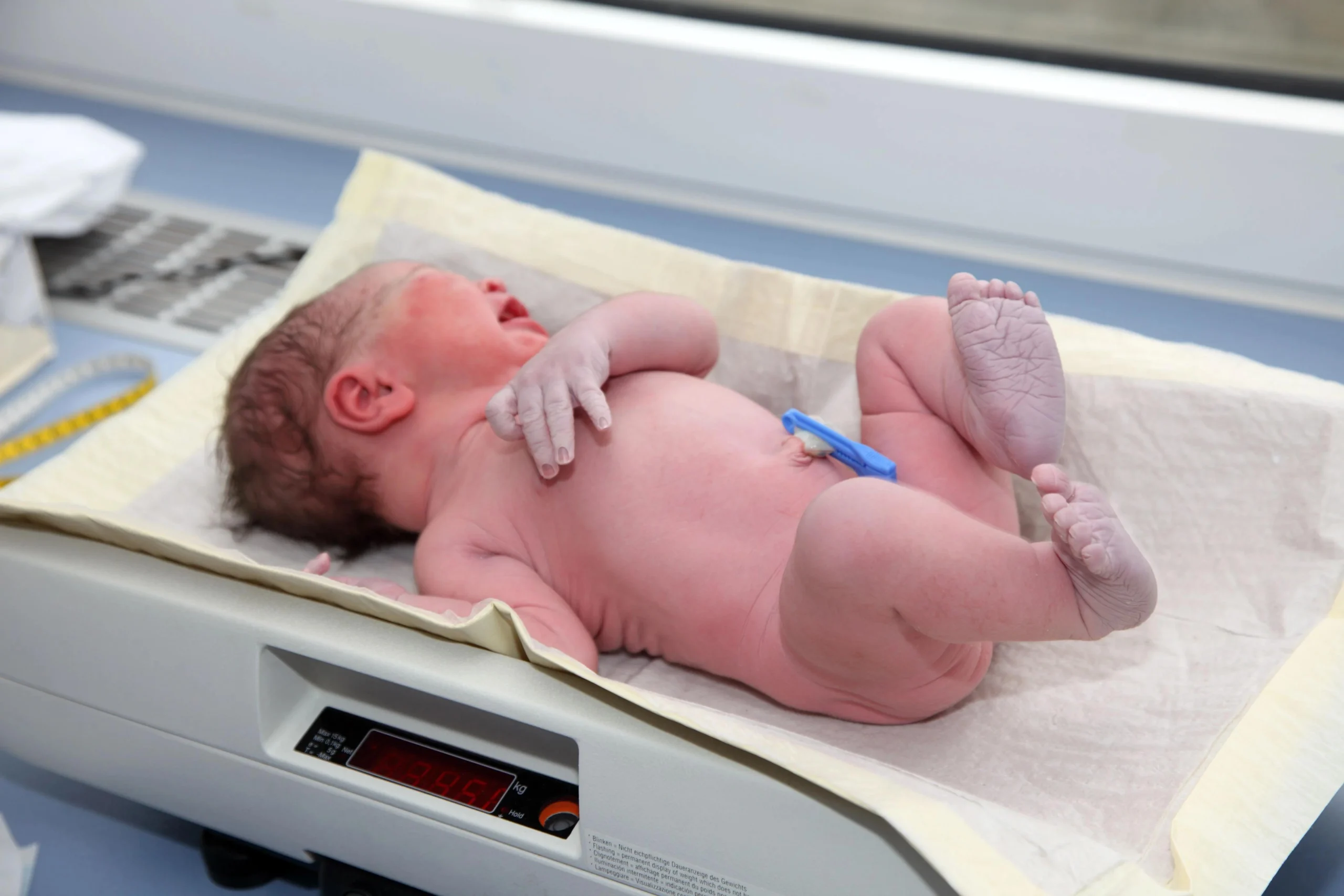warum nehmen babys nach der geburt ab - Warum nimmt Kind nach Geburt ab