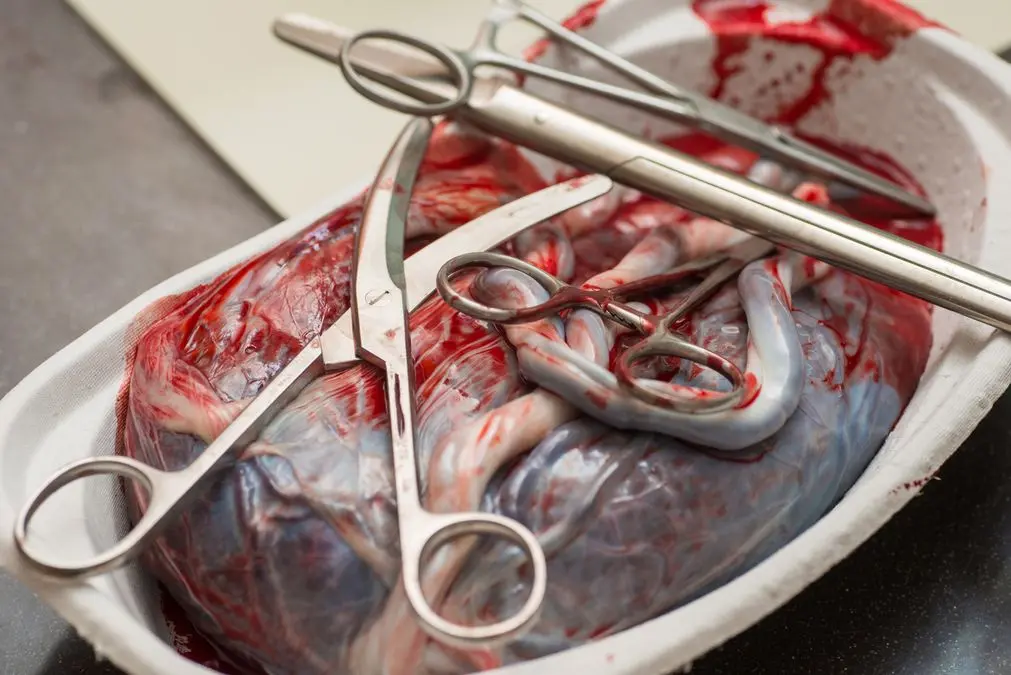 Lotusgeburt: Was ist das und welche Vor- und Nachteile gibt es? - Warum Plazenta behalten lotus geburt - Warum Plazenta behalten