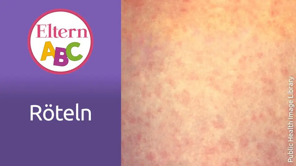 röteln schwangerschaft - Warum Röteln Impfung Schwangerschaft
