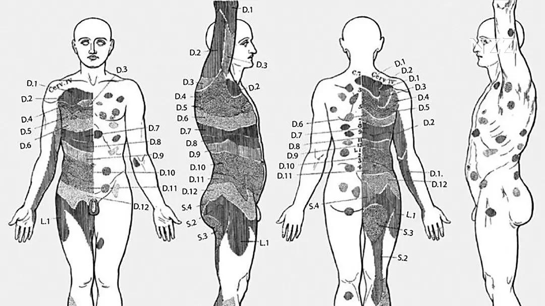 linker arm tut weh schwangerschaft - Warum tut der linke Arm bei einem Herzinfarkt weh