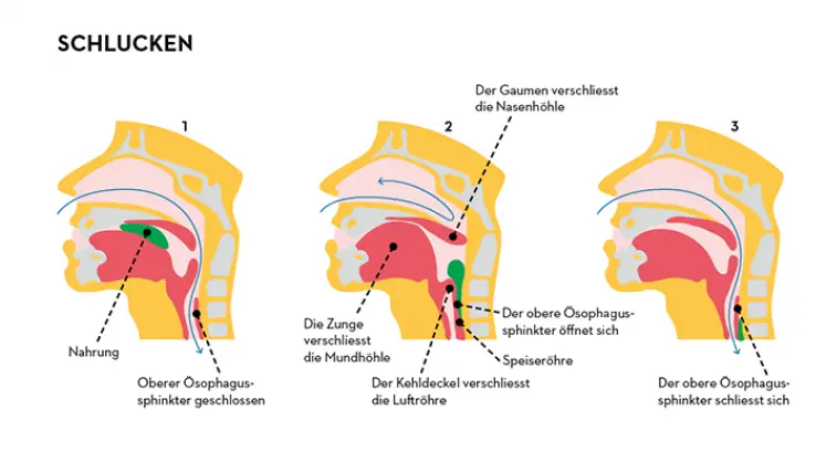 Der Durchmesser der Speiseröhre: Ein wichtiger Faktor für die Verdauung - Warum verengt sich die Speiseröhre durchmesser speiseröhre - Warum verengt sich die Speiseröhre