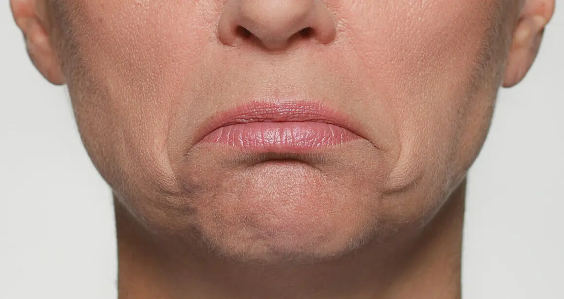 gesicht zuckt - Warum zuckt eine Gesichtshälfte