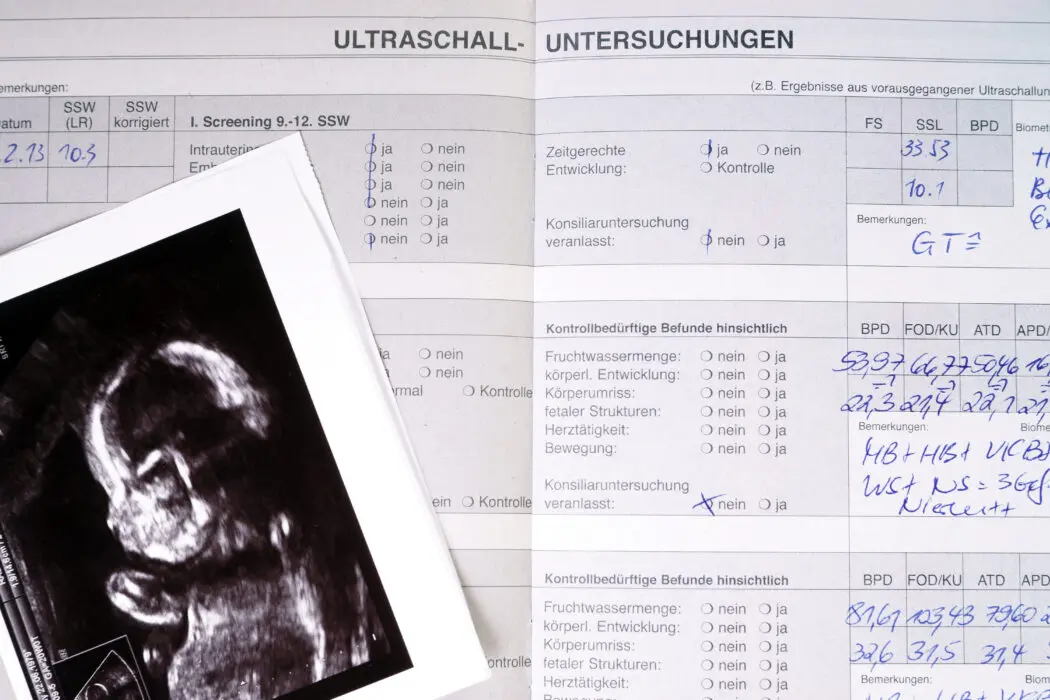 abkürzungen schwangerschaft - Was bedeuten die Abkürzungen auf dem Ultraschall