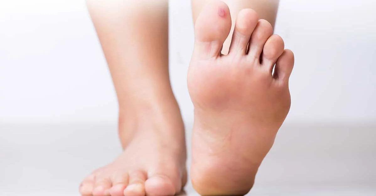 kleines bläschen auf der haut - Was bedeuten Wasserblasen auf der Haut