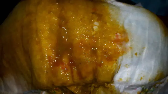 baby blut im stuhl schleim - Was bedeutet Blut im Stuhl bei Babys