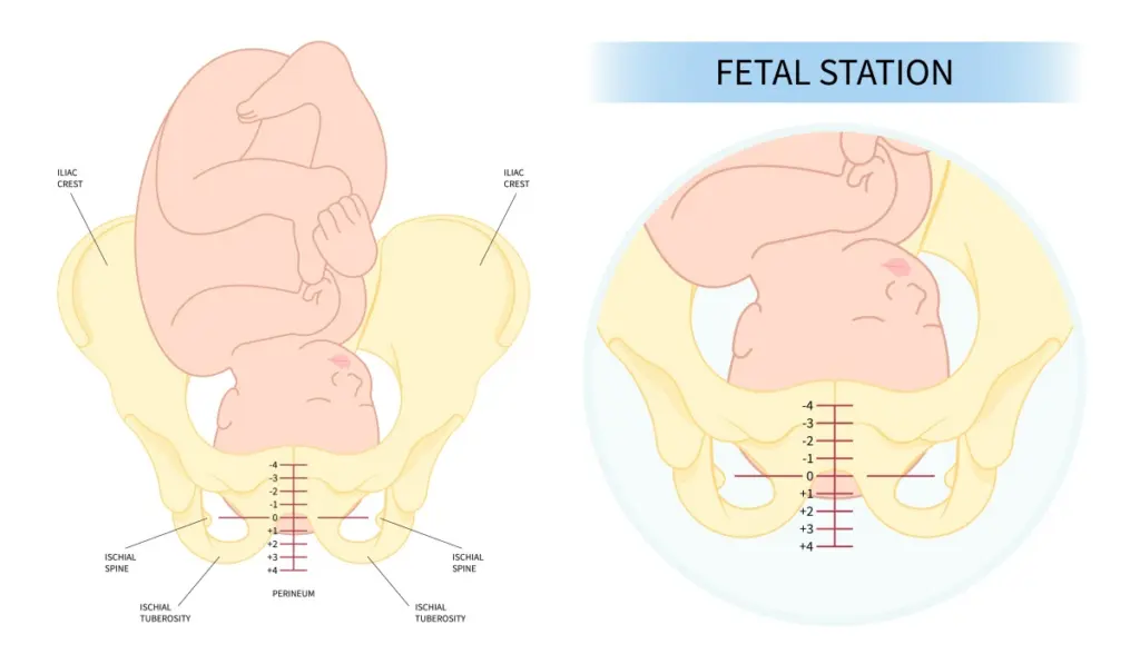 sternengucker geburt - Was bedeutet die Hinterhauptslage bei der Geburt