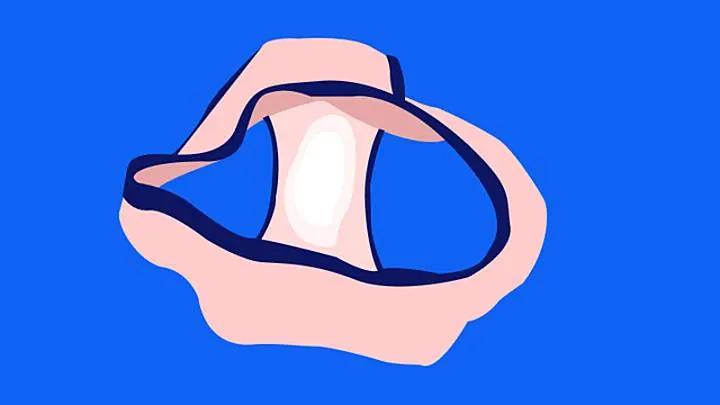 nasse unterhose schwangerschaft - Was bedeutet es wenn die Unterhose nass ist