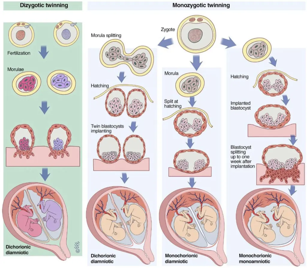 zwillinge eine plazenta - Was bedeutet es wenn man 2 Plazenta hat