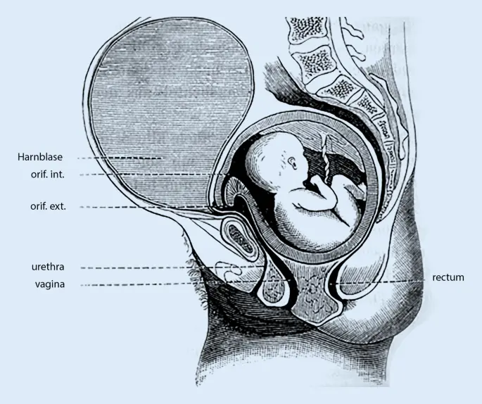 anteflektierter uterus schwangerschaft - Was bedeutet Gebärmutter gestreckt