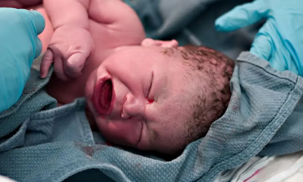 sp geburt - Was bedeutet SPP bei Geburt