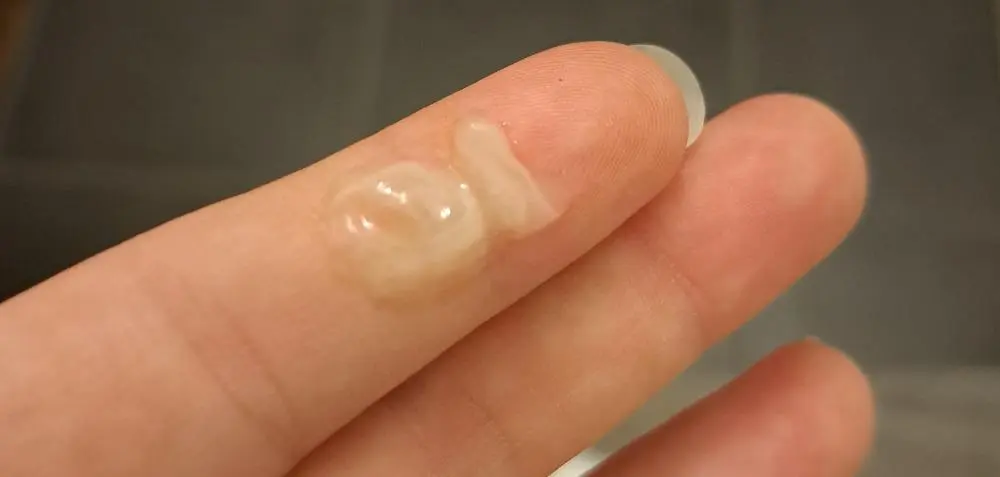 durchsichtiger ausfluss vor geburt - Was bedeutet wässriger durchsichtiger Ausfluss