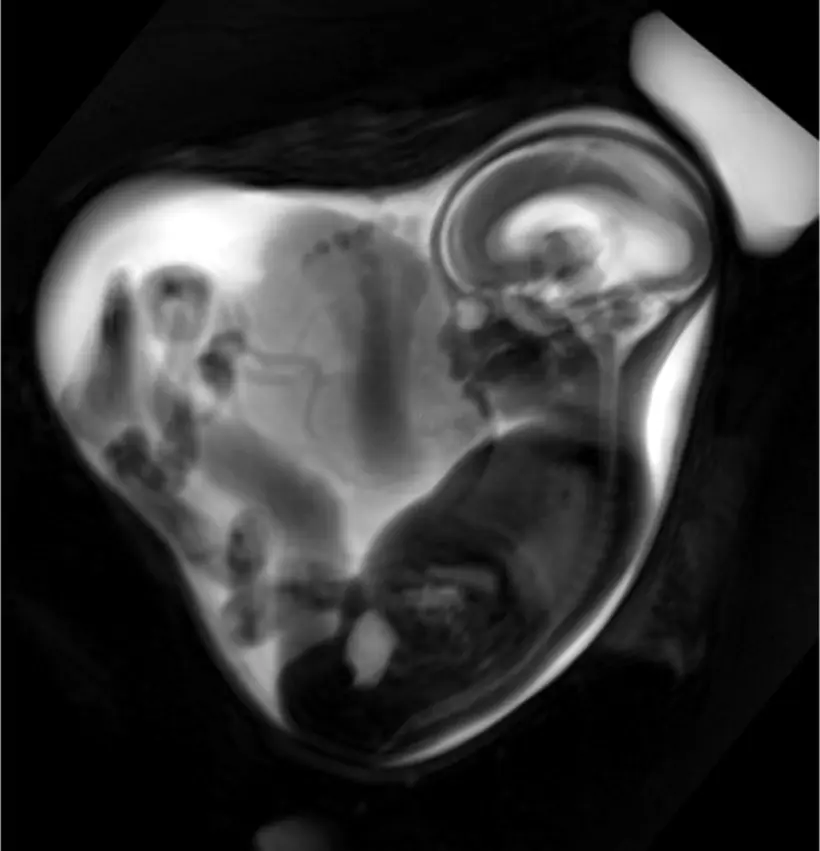 MRT Kopf Schwangerschaft: Was Sie wissen müssen - Was darf man vor Kopf MRT nicht machen mrt kopf schwangerschaft - Was darf man vor Kopf MRT nicht machen