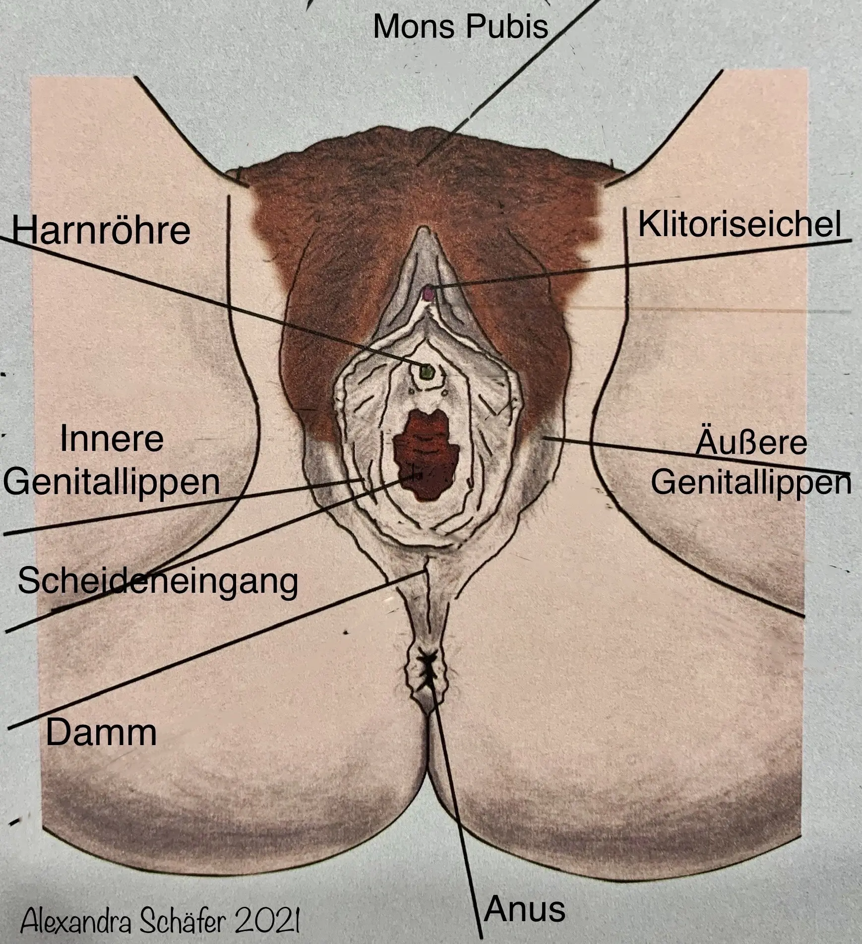 geburt riss scheide - Was hilft bei Eingerissener Scheide