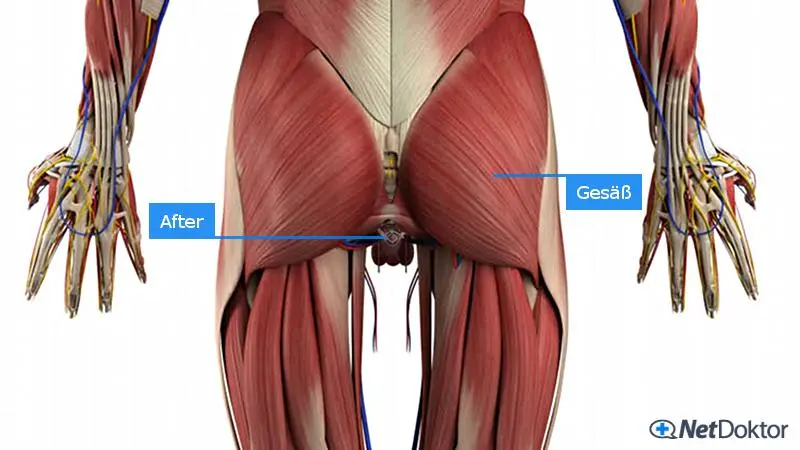 afterjucken schwangerschaft - Was hilft sofort gegen Afterjucken
