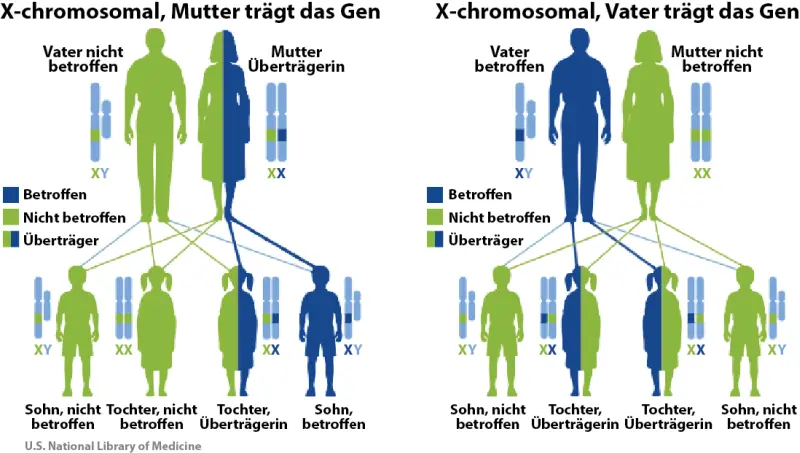 ald geburt - Was ist Adrenomyeloneuropathie
