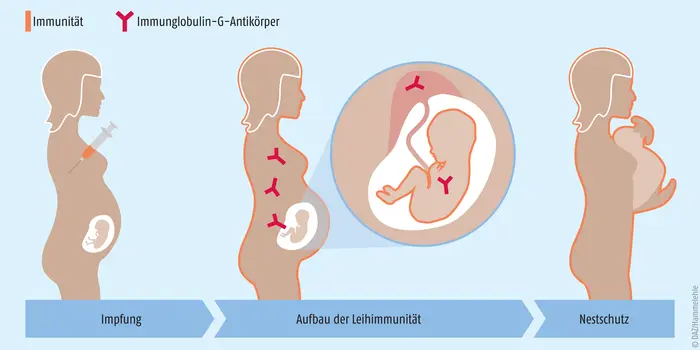 covaxis impfung schwangerschaft - Was ist COVAXiS für eine Impfung
