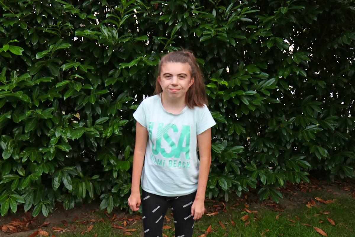 cornelia-de-lange-syndrom schwangerschaft - Was ist das Cornelia de Lange Syndrom