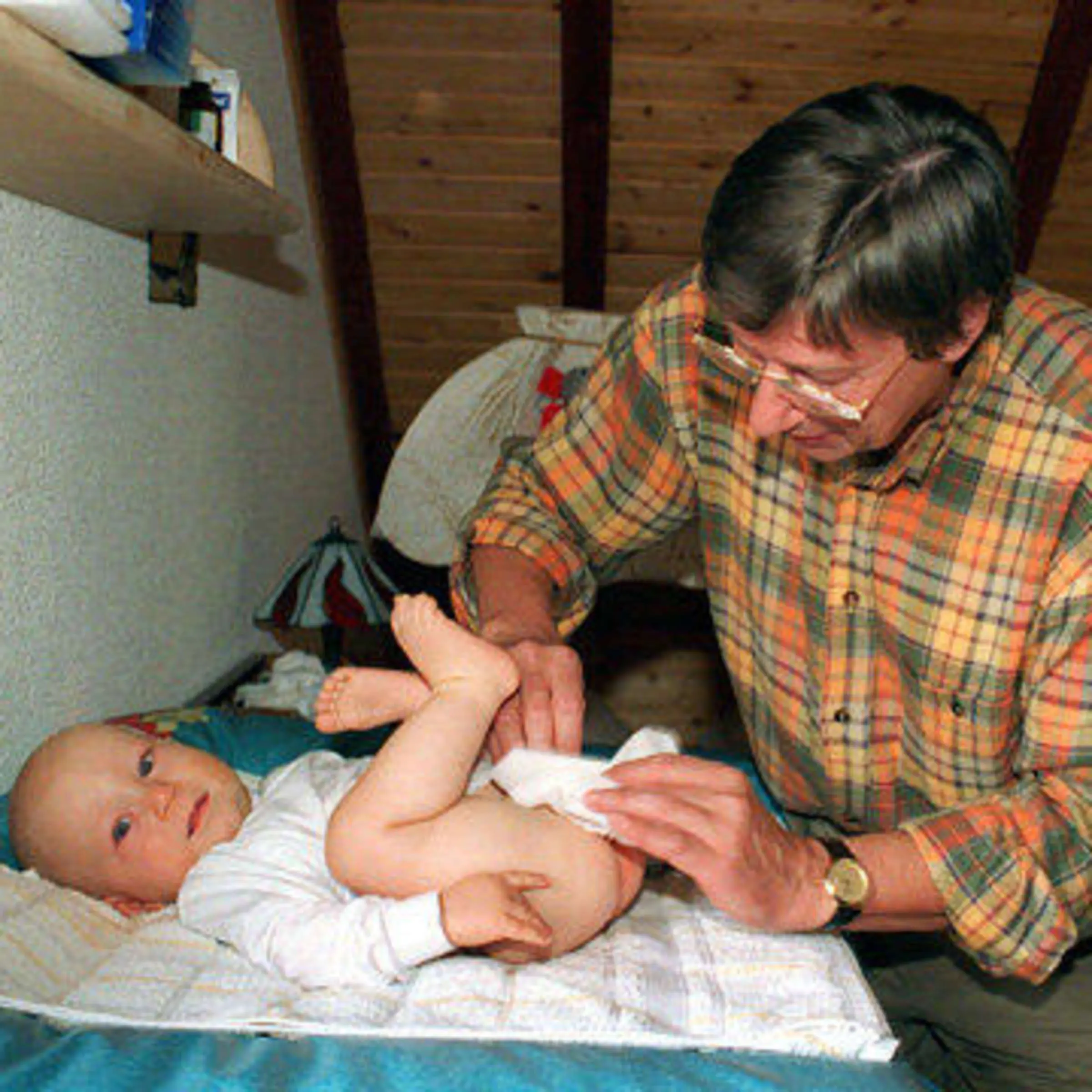 marfan syndrom geburt - Was ist das Marfan-Syndrom bei Babys