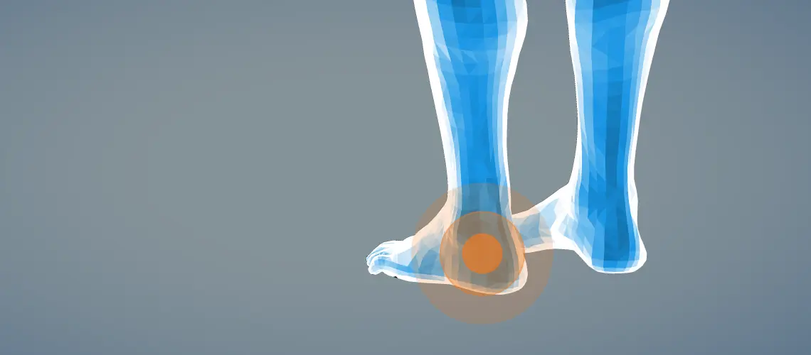 fersenschmerzen schwangerschaft - Was ist das wenn die Ferse beim Auftreten schmerzt