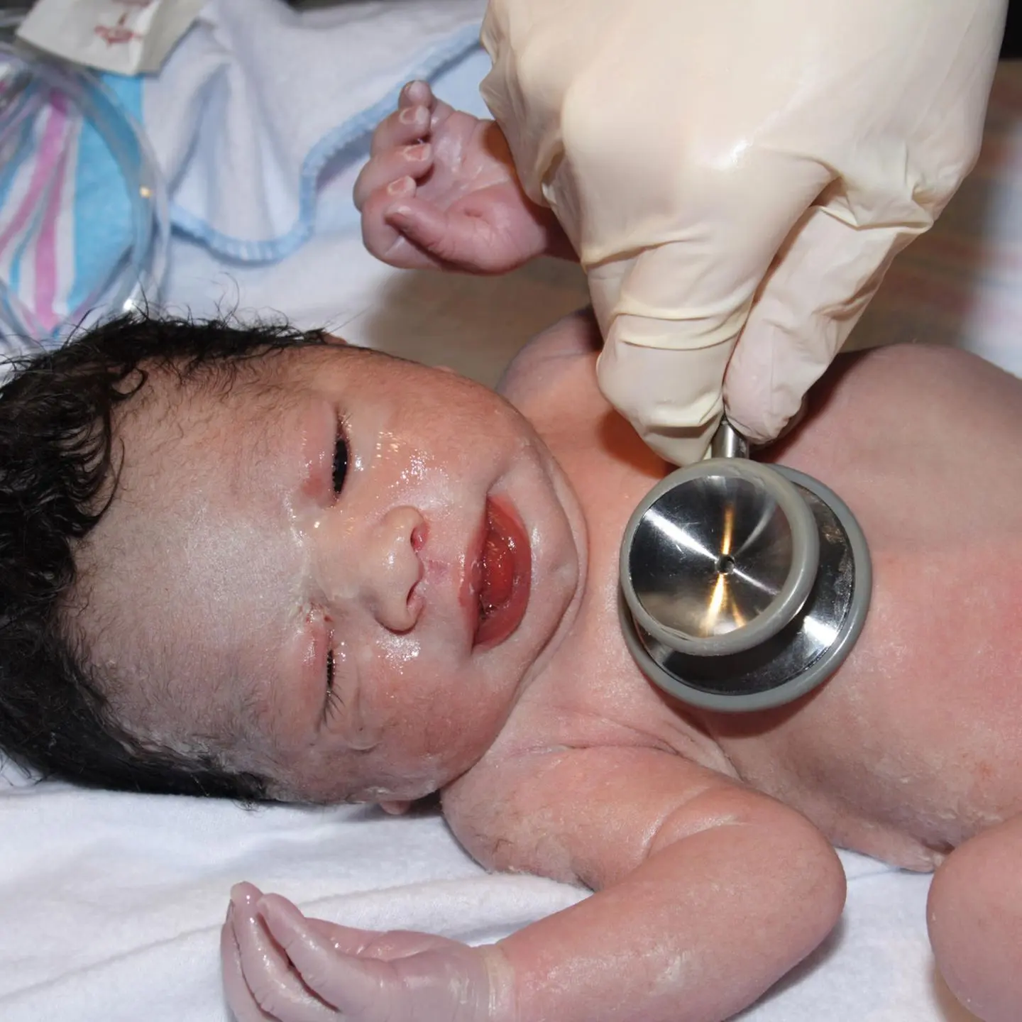 nvph geburt - Was ist der normale pH-Wert für ein Neugeborenes