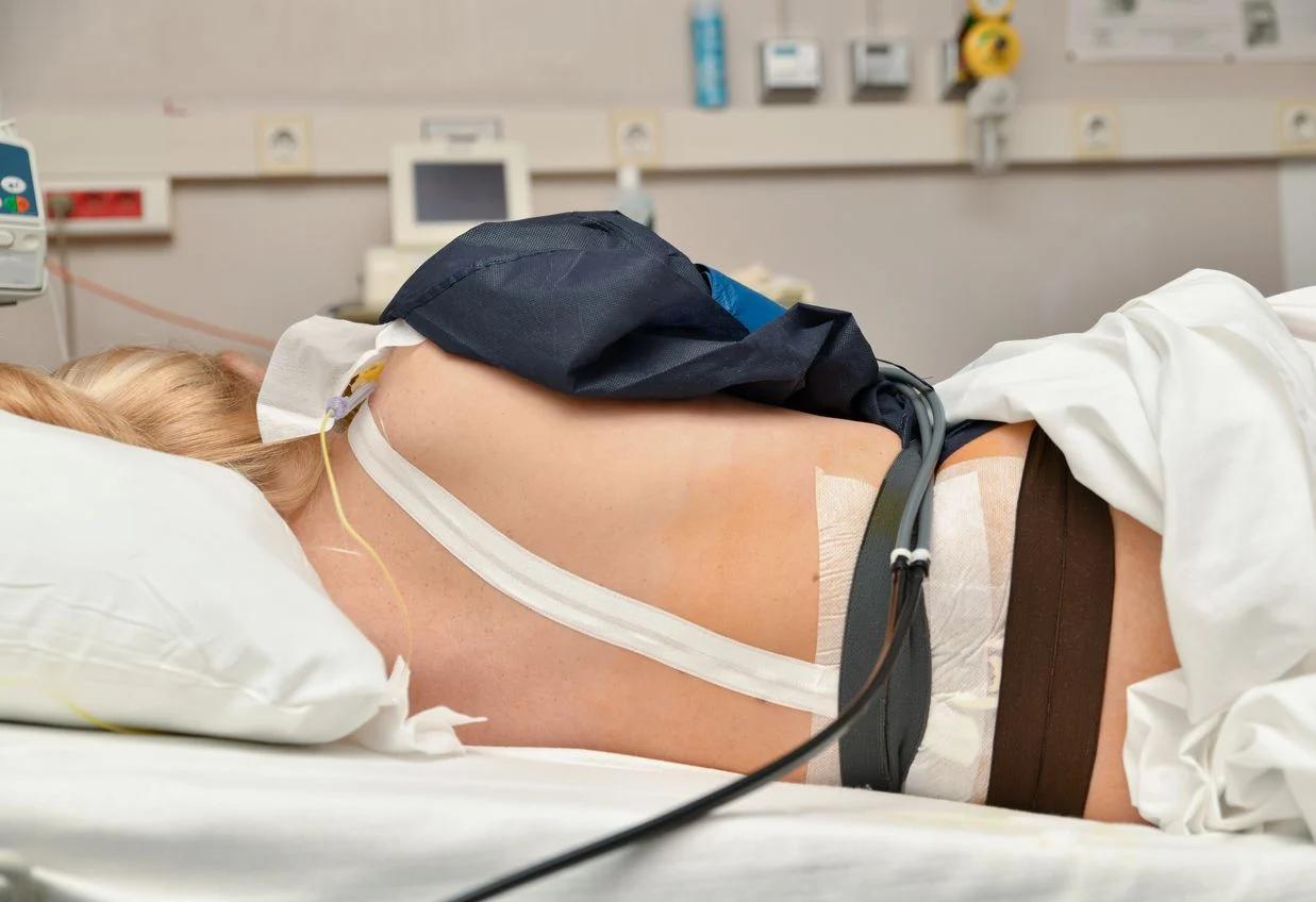epidural geburt - Was ist der Unterschied zwischen epidural und Spinalanästhesie