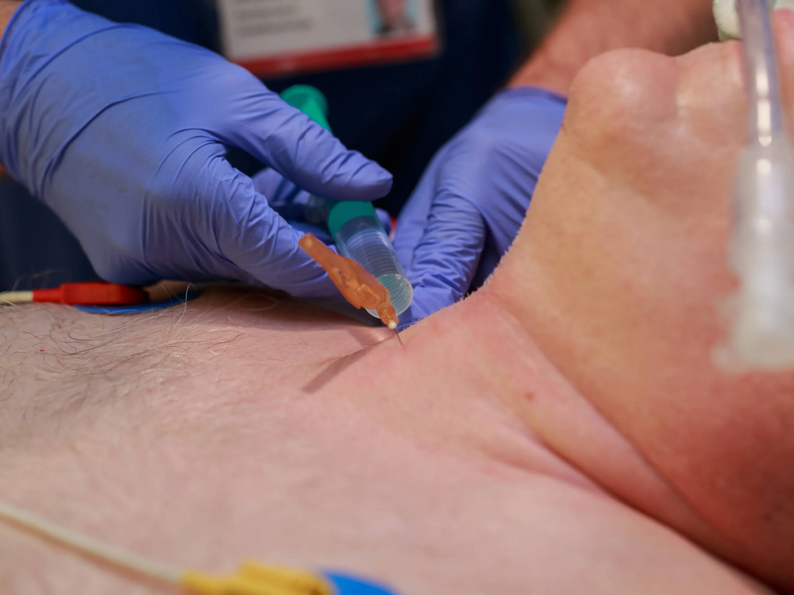 pdk geburt - Was ist der Unterschied zwischen PDA und PDK