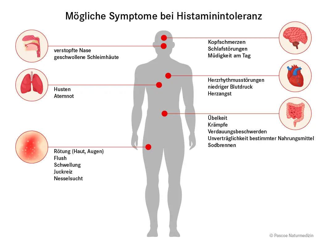 histaminintoleranz hautrötung - Was ist ein Histamin Ausschlag