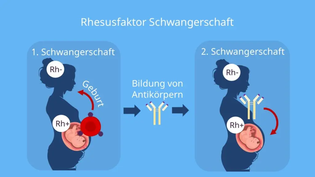 ab0 inkompatibilität schwangerschaft - Was ist eine AB0 Inkompatibilität