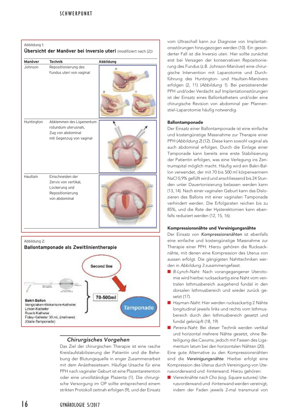 atonie geburt ursachen - Was ist eine atonie Geburt