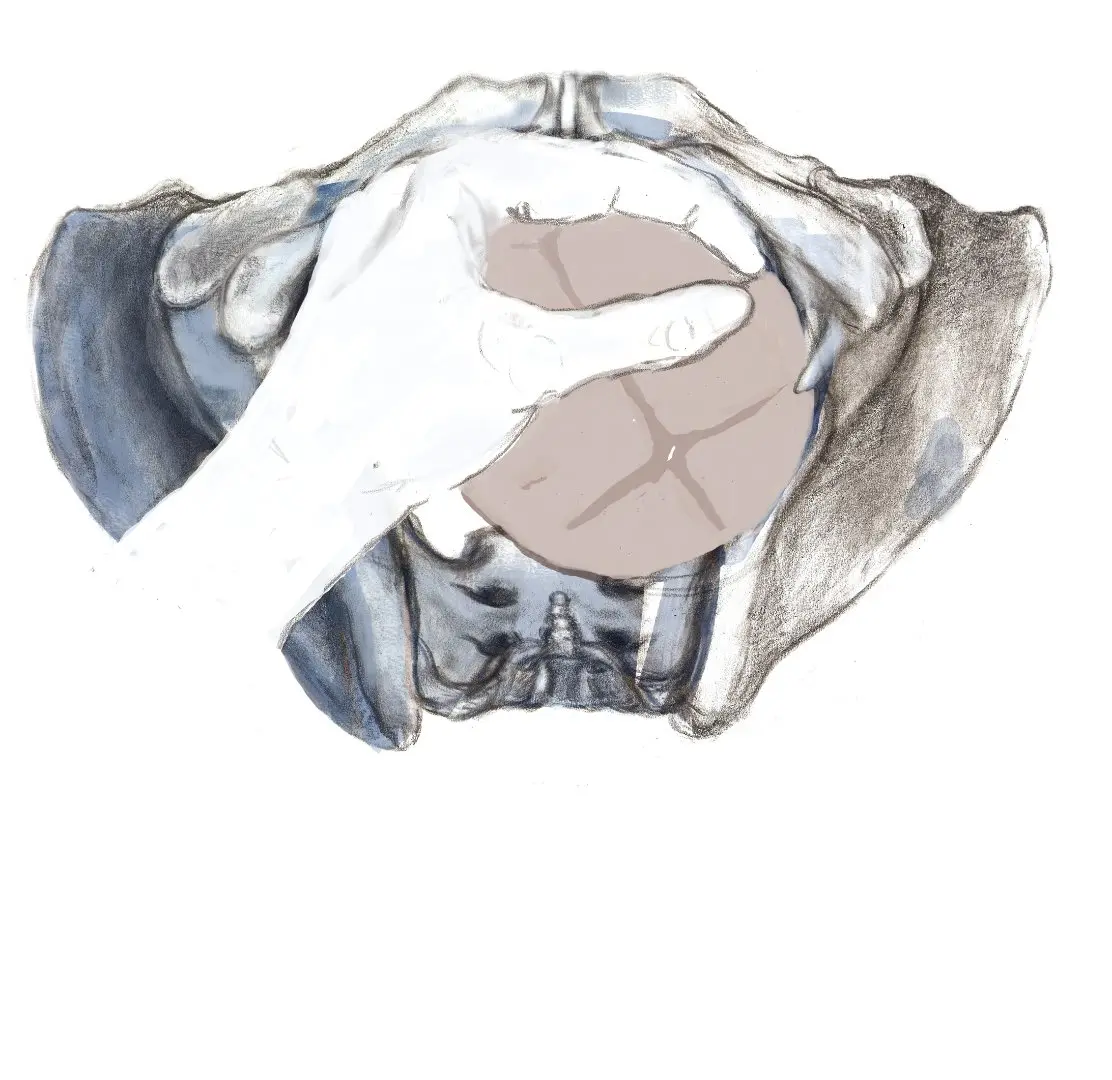 Protrahierte Geburt: Eine umfassende Analyse - Was ist eine protrahierte Geburt protrahiert geburt - Was ist eine protrahierte Geburt