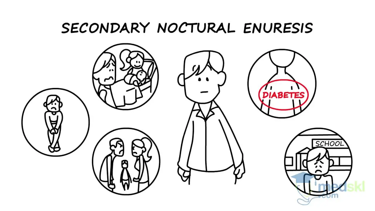 primäre enuresis - Was ist eine sekundäre Enuresis
