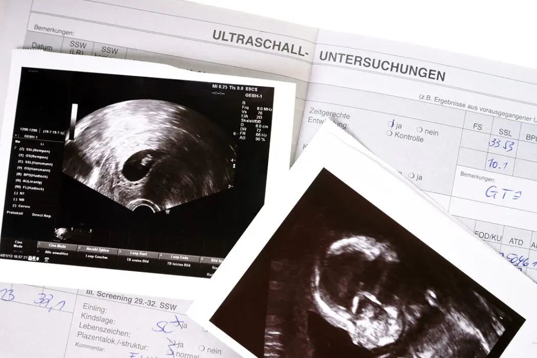 sonographie schwangerschaft - Was ist eine Sonographie beim Frauenarzt