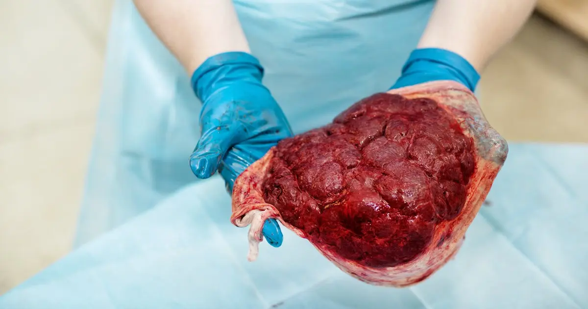 vwp schwangerschaft - Was ist eine VWP