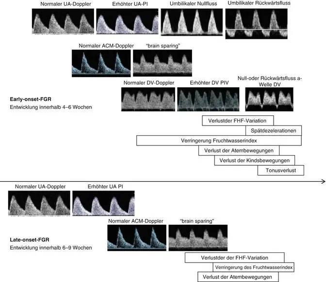 fgr schwangerschaft - Was ist Fgr