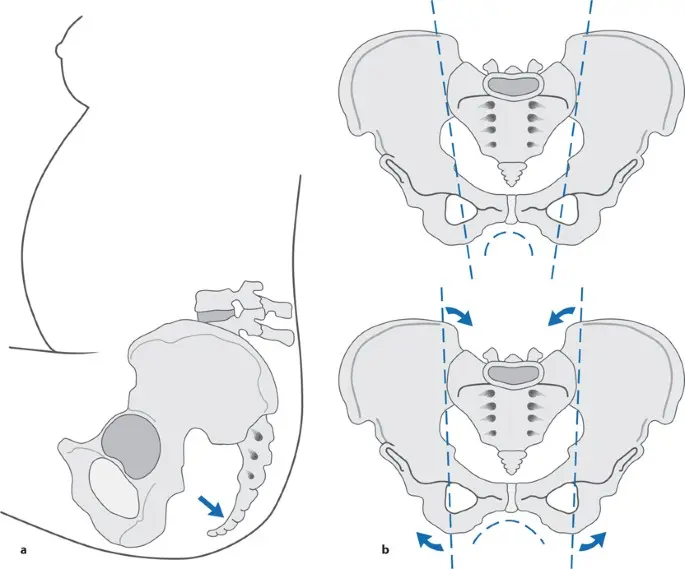 interspinallinie geburt - Was ist Interspinalebene