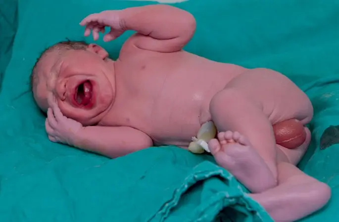 hoden bei babys - Was ist wenn der Hoden hoch rutscht