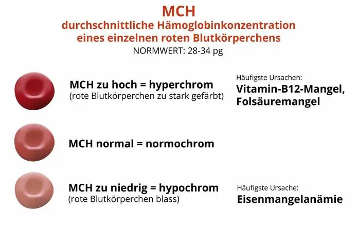 mch wert - Was ist wenn der MCHC zu niedrig ist