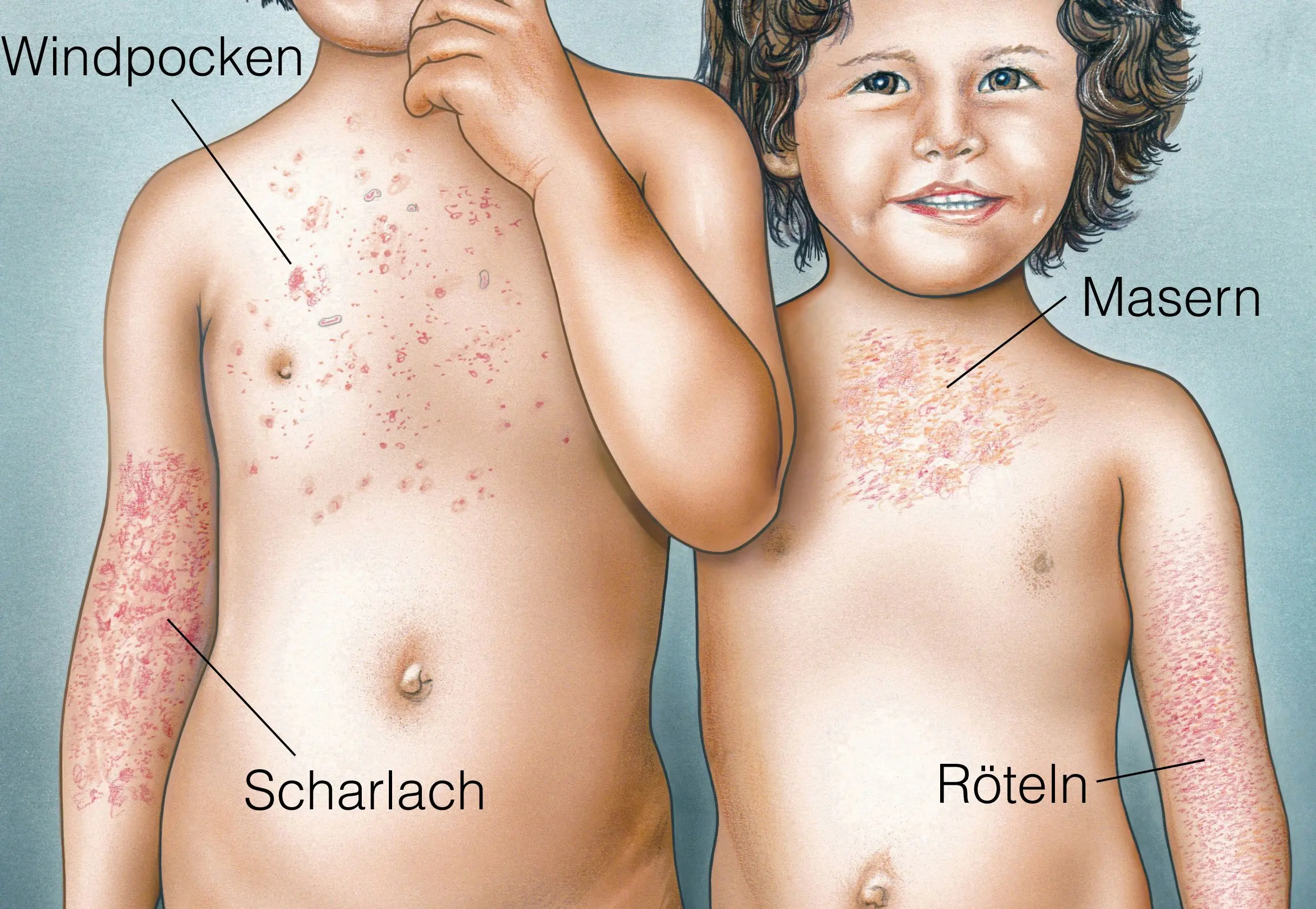 ausschlag bauch kind - Was kann Ausschlag am Bauch sein