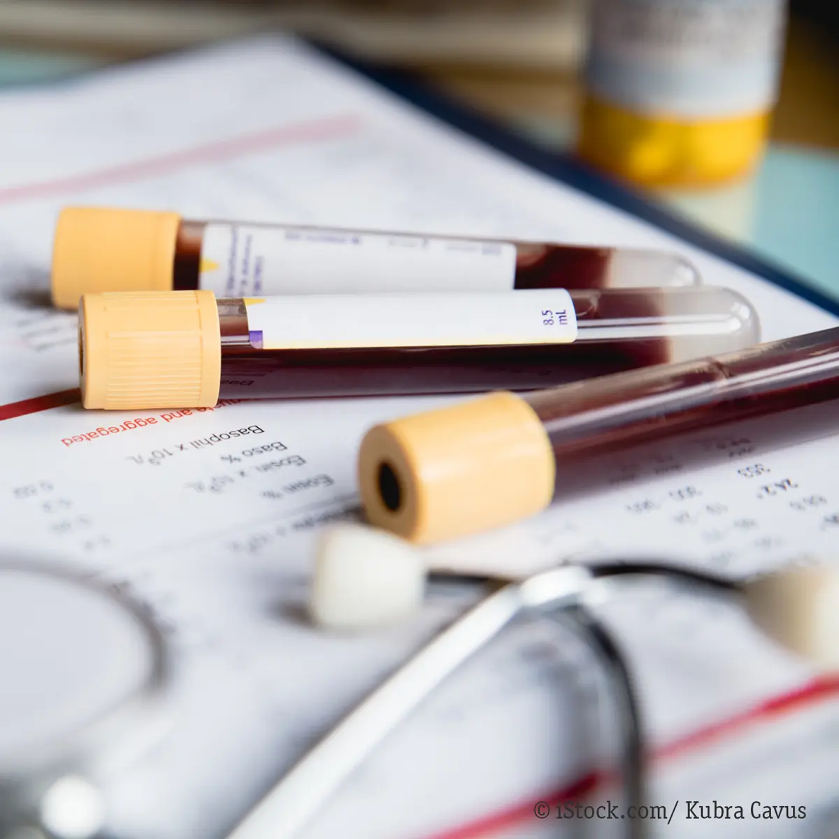 Zu hohes Cholesterin in der Schwangerschaft - Was kann bei zu hohem Cholesterin passieren zu hohes cholesterin in der schwangerschaft - Was kann bei zu hohem Cholesterin passieren