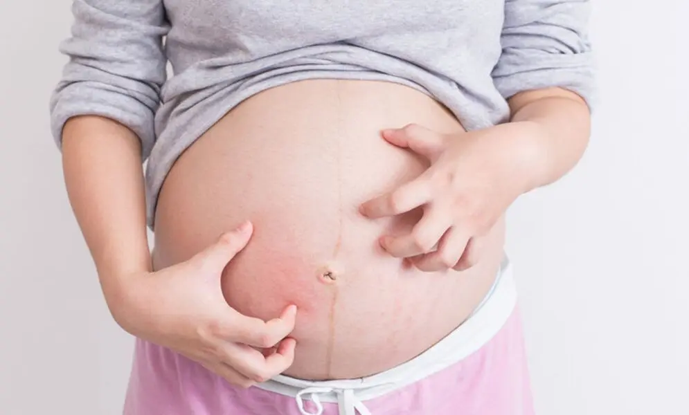 juckende beine schwangerschaft - Was kann Juckreiz an den Beinen bedeuten