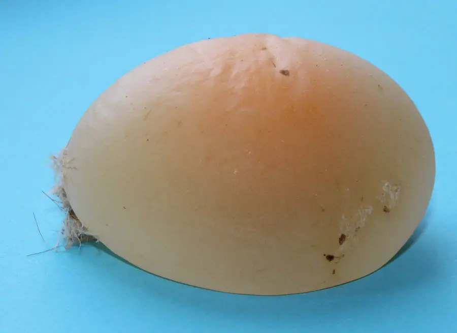 windeier schwangerschaft - Was kann man gegen Windeier tun