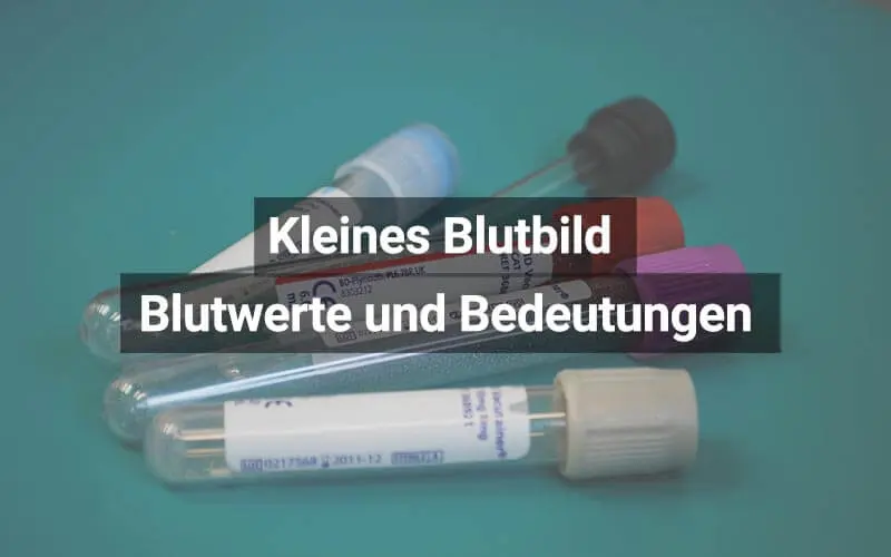 kleines blutbild schwangerschaft - Was kann man im kleinen Blutbild erkennen