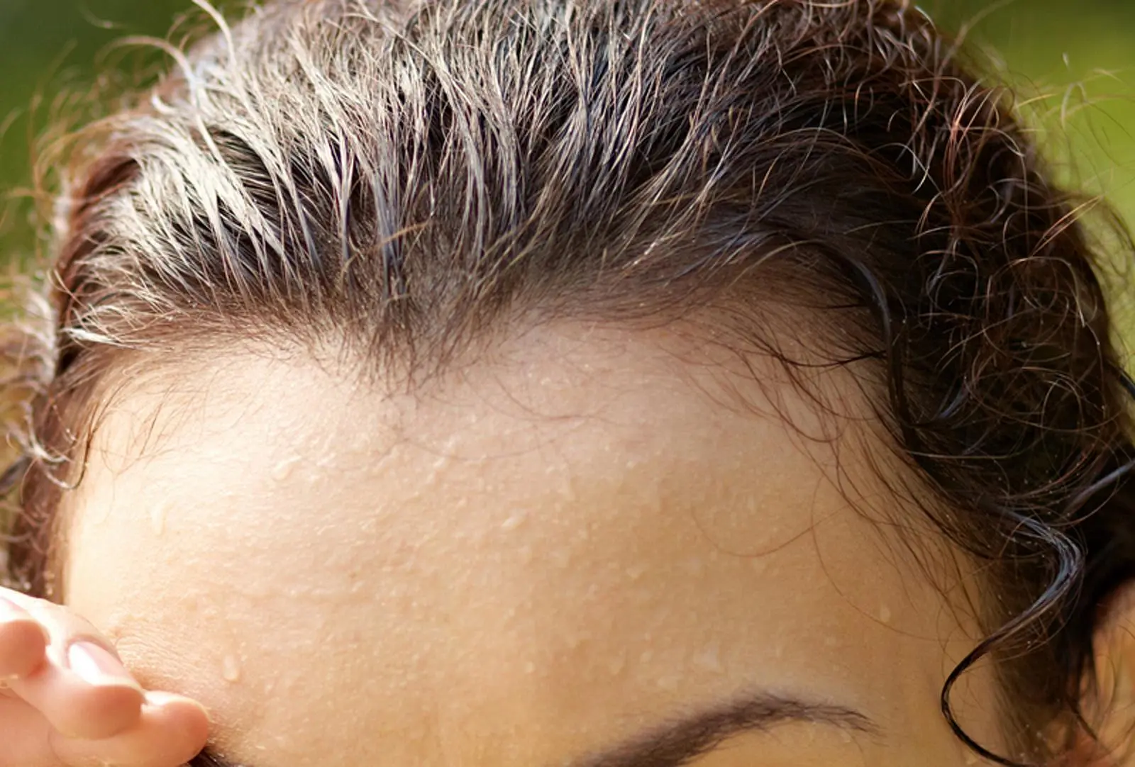 kind schwitzt stark am kopf - Was kann man tun gegen starkes Schwitzen am Kopf