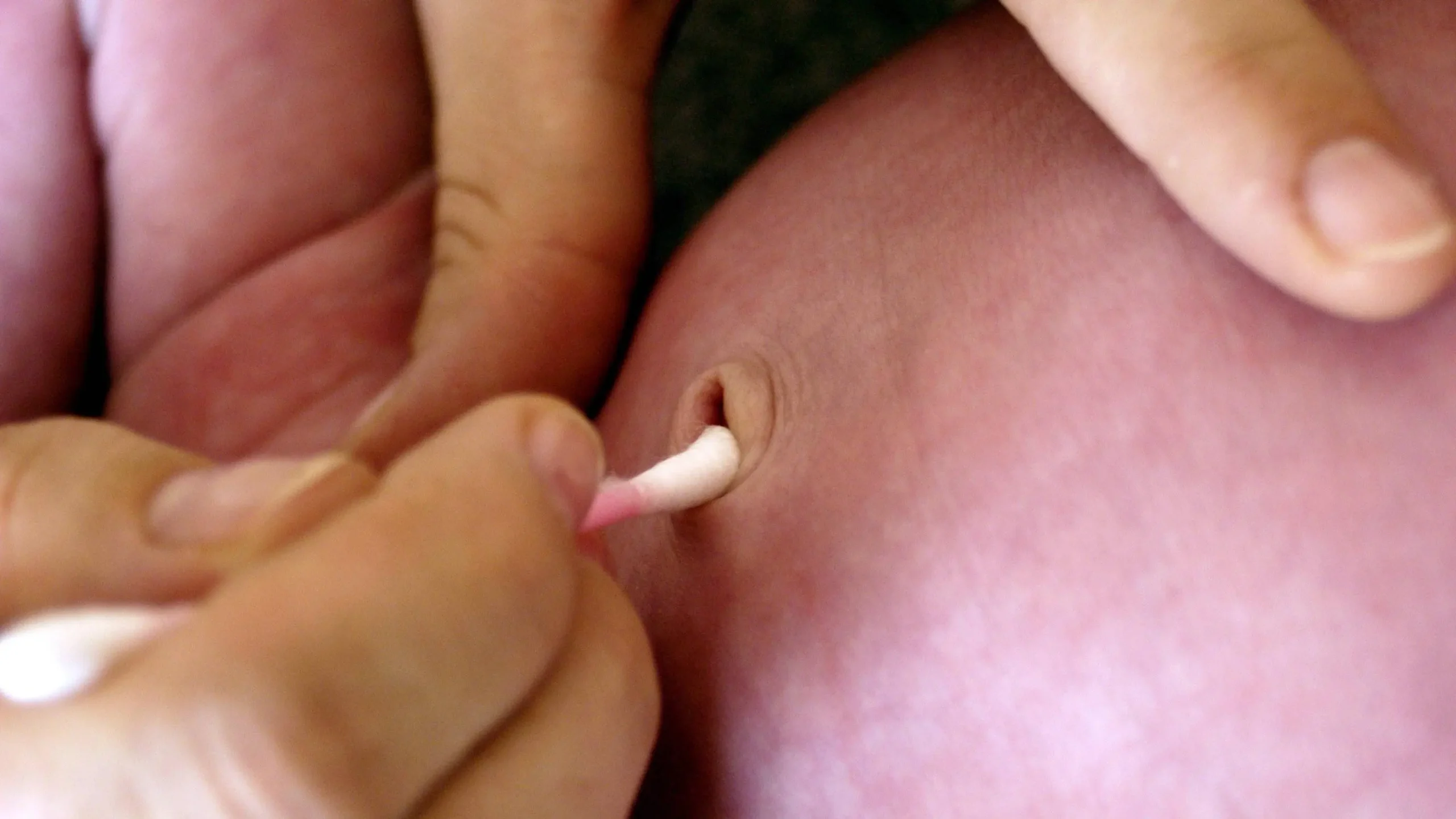 bauchnabel jucken - Was kann man tun wenn der Bauchnabel juckt