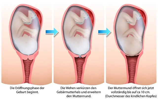 latenzphase geburt - Was kommt nach Latenzphase