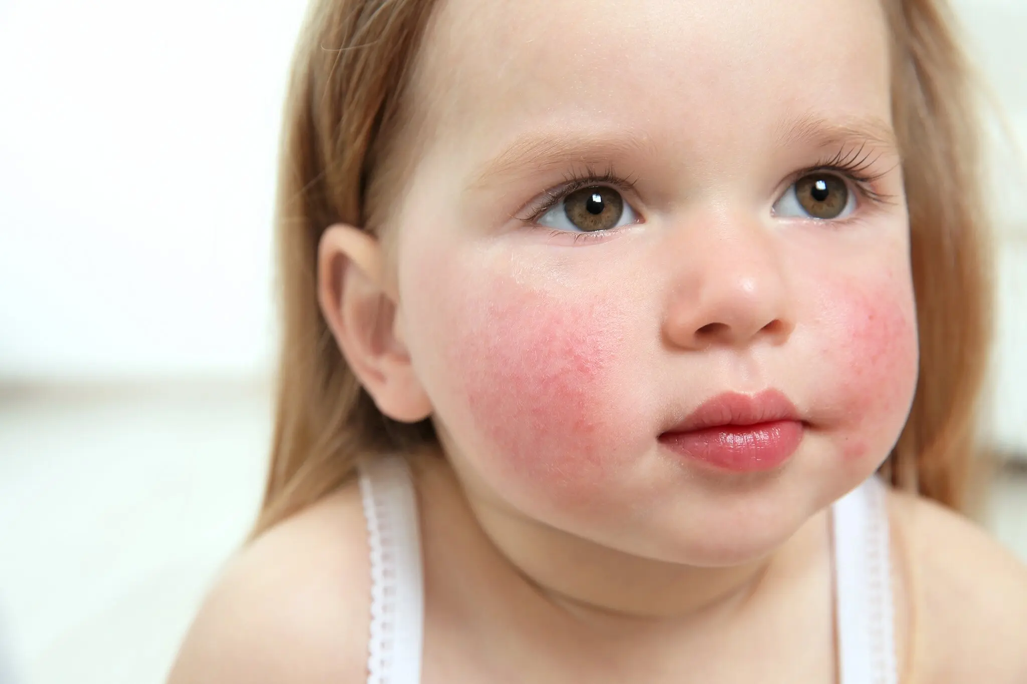 ringelrötel test schwangerschaft - Was kostet ein Test auf Ringelröteln