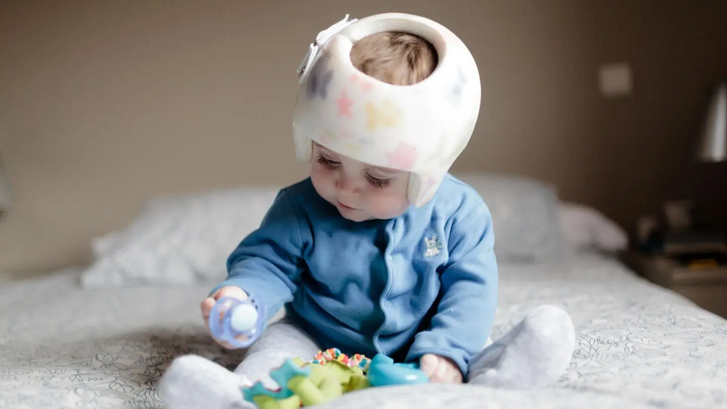 helm baby kopfverformung - Was kostet Helmtherapie Baby