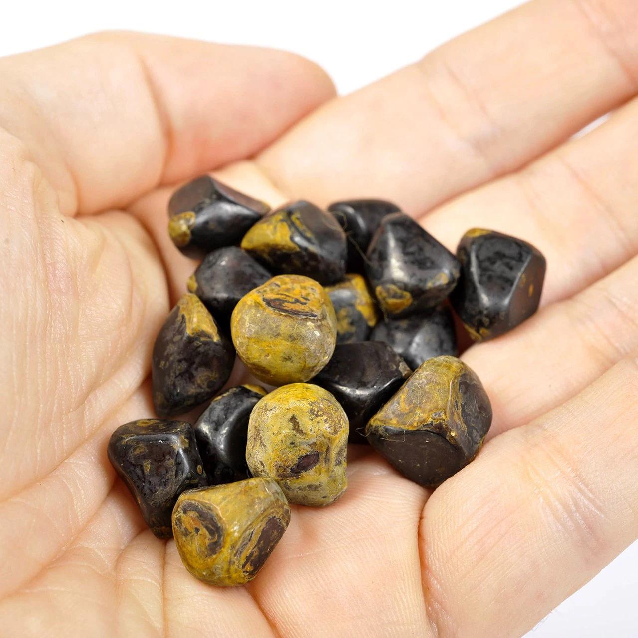 gallenstein bei kindern - Was löst Gallenstein aus